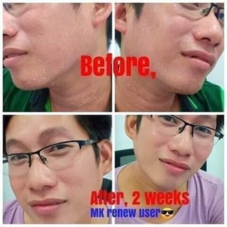 LookingFour