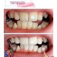 Ap24 Whitening Toothpaste